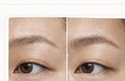 Skin brightening before and after